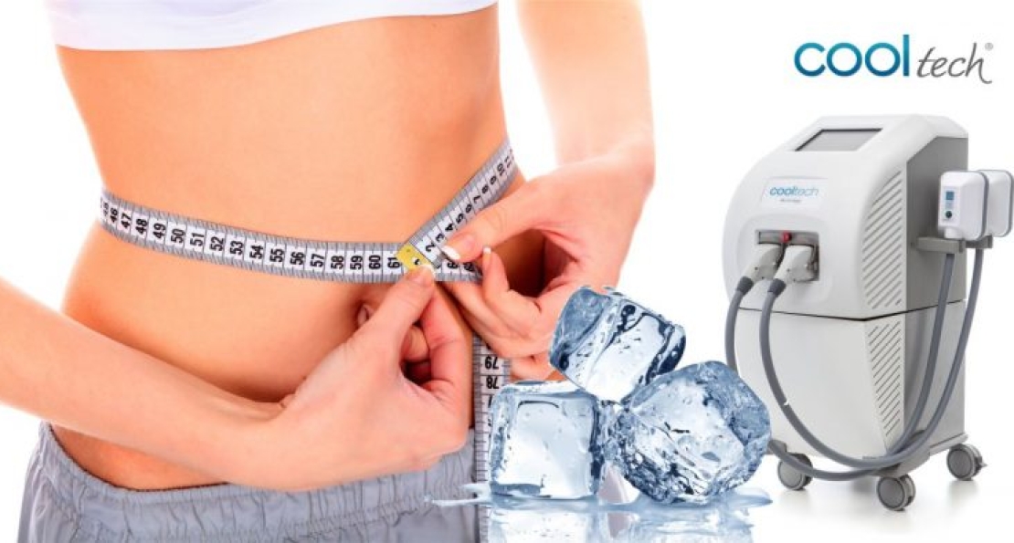 Κρυολιπόλυση: Μη Επεμβατική Θεραπεία για Τοπικό Πάχος