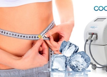 Κρυολιπόλυση: Μη Επεμβατική Θεραπεία για Τοπικό Πάχος